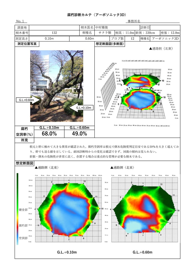 アーボソニック3Dカルテ