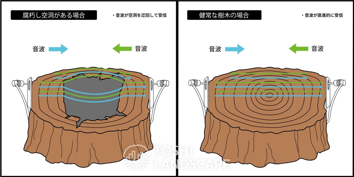 ピカス トモグラムの原理