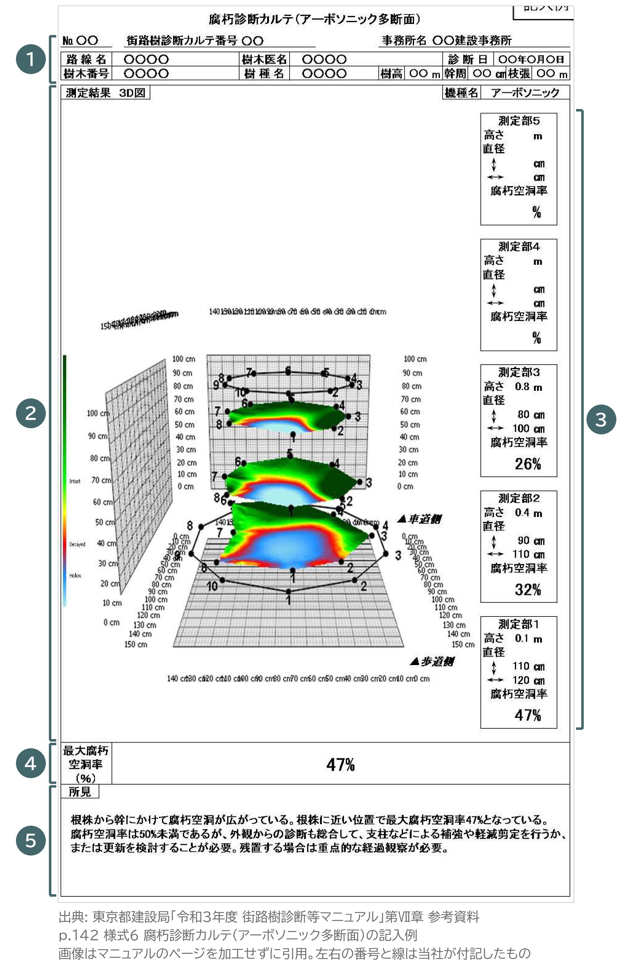 腐朽診断カルテ アーボソニック 多断面 記入例 様式6 3D図 測定部 最大腐朽空洞率